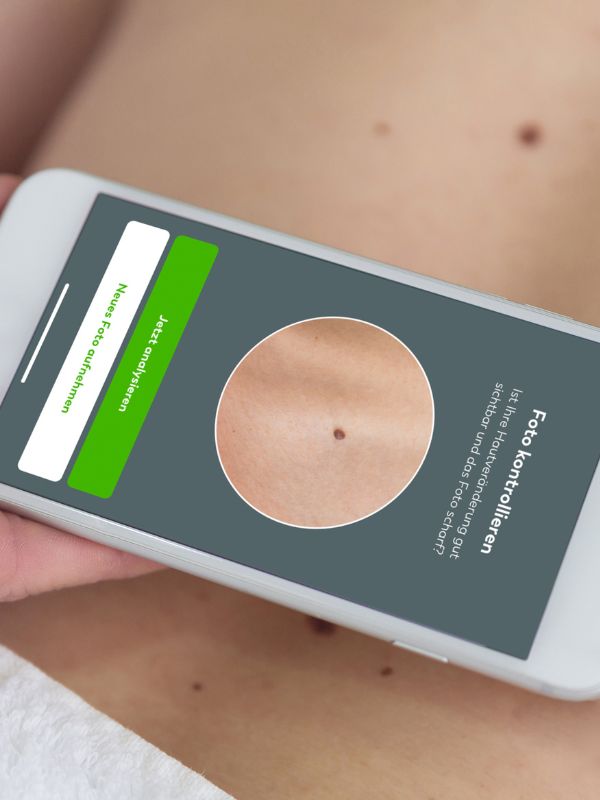 SkinScreener